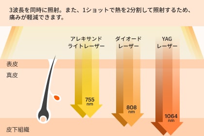 痛みの少ないとされるダイオードレーザーを採用。お肌への負担が少ない機種で毛包だけに無駄なく照射。