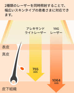 2種類のレーザーを同時照射することで、幅広いスキンタイプの患者様に対応できます。